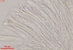 Hymenoscyphus albopunctus