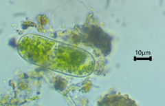 Cylindrocystis