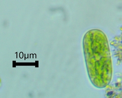 Cylindrocystis