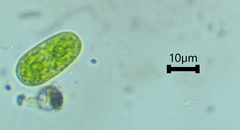Cylindrocystis