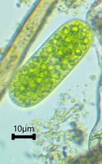 Cylindrocystis