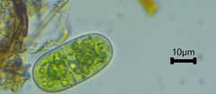 Cylindrocystis