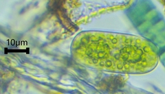 Cylindrocystis