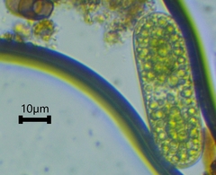 Cylindrocystis