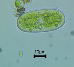 Cylindrocystis