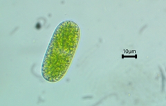 Cylindrocystis