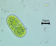 Cylindrocystis