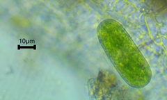 Cylindrocystis