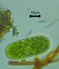 Cylindrocystis