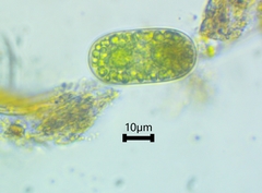 Cylindrocystis