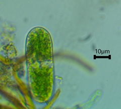 Cylindrocystis