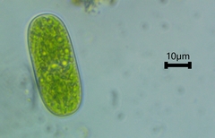 Cylindrocystis