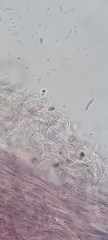 Rhodocollybia prolixa distorta