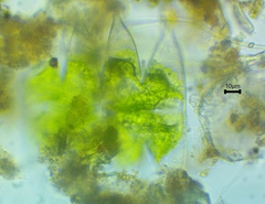 Micrasterias laticeps