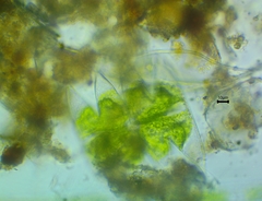 Micrasterias laticeps