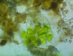 Micrasterias laticeps