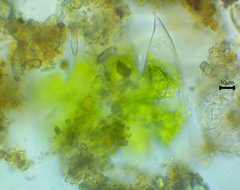 Micrasterias laticeps