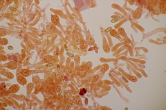 Hortiboletus bubalinus