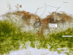 Cronartium ribicola