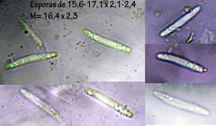 Pyrenopeziza carduorum