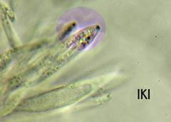 Pyrenopeziza carduorum