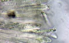 Pyrenopeziza carduorum