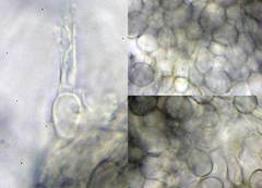 Pyrenopeziza carduorum