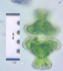Euastrum intermedium