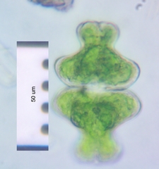 Euastrum intermedium