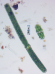 Pleurotaenium maximum