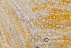 Ramsbottomia asperior