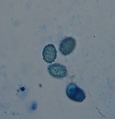 Scutellinia fujianensis