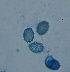 Scutellinia fujianensis