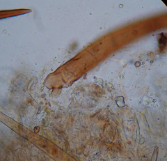 Scutellinia fujianensis