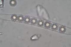 Octospora maireana