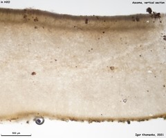 Peziza atrovinosa