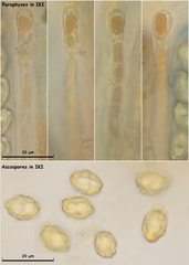 Peziza atrovinosa