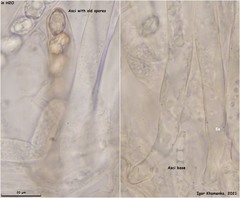 Peziza atrovinosa