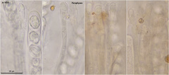 Peziza atrovinosa