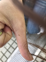 Insecta