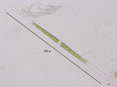 Closterium idiosporum