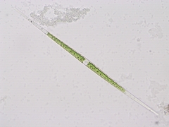 Closterium idiosporum