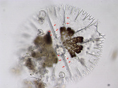 Micrasterias compereana