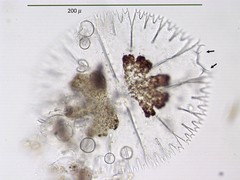 Micrasterias compereana