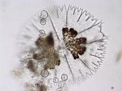 Micrasterias compereana