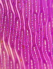 Sphagnum macrophyllum