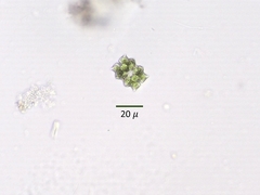 Euastrum abruptum