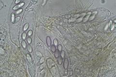 Ascobolus hawaiiensis