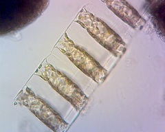 Lithodesmium