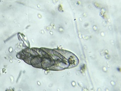 Bolivinitidae